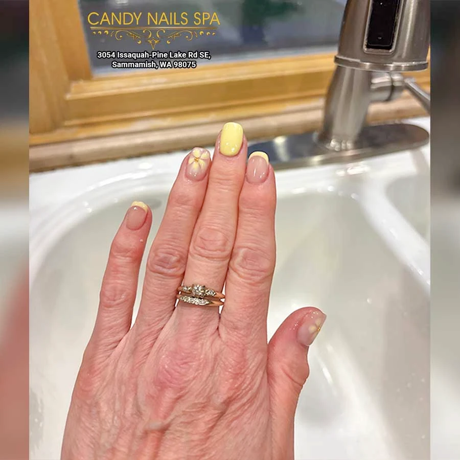 Nail August 12